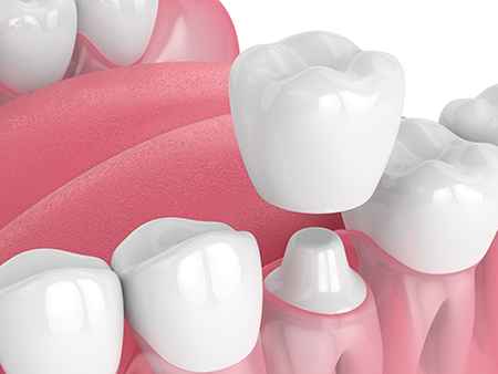 PebblePath Pediatric Dentistry Orthodontics