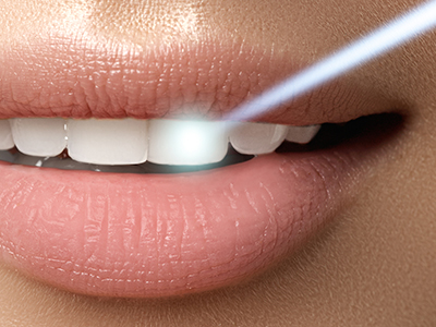 PebblePath Pediatric Dentistry   Orthodontics | Sports Mouthguards, Teeth Whitening and E4D